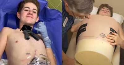 Man Who Was Cut In Half In A Forklift Incident Explains How He Poops, Pees And Farts