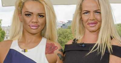 Mother Daughter Duo Spent $86K On Matching Plastic Surgery