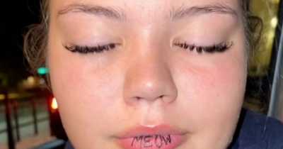 A Woman Accidentally Gets 'Meow' Tattooed On Outside Of Lip Instead Of Inside