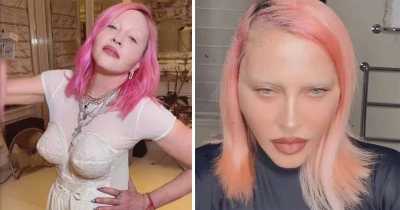 Madonna's "New Face" is Freaking Her Fans Out