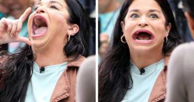 People With Exceptionally Extraordinary Body Parts