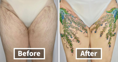 Gorgeous Scar Cover Up Tattoos That Leave No Trace