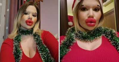 Woman With 'World's Biggest Lips' Auctioning Off Christmas Kisses Under The Mistletoe