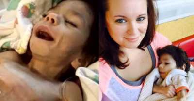 Woman Rescues 8-Year-Old Orphan Weighing Only 8 Pounds and Offers Loving Home