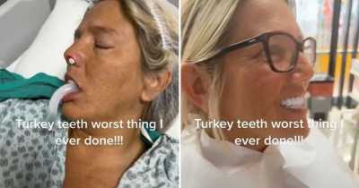 "I Got Turkey Teeth That Looks Ridiculous - It Was The Worst Mistake Of My Life"