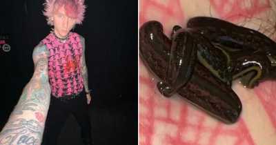 Machine Gun Kelly Puts Leeches On His Bare Stomach