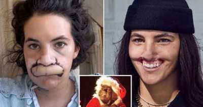 "I Lost My Lip After Vicious Dog Hung Onto My Face &ndash;&nbsp;Now Trolls Call Me The Grinch"