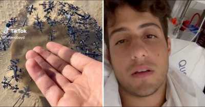 Man Ends Up Hospitalized After Holding Blue Dragons: 'It's Okay I'm a Professional'