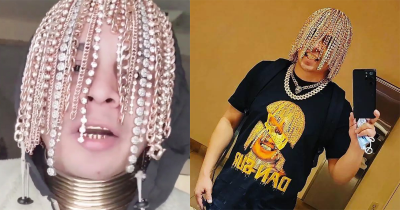 Rapper Has Gold Chains Surgically Implanted In His Skull