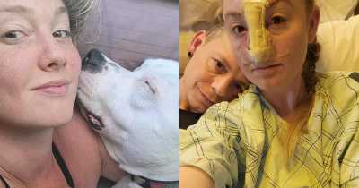 Woman's Nose Ripped Off By Boyfriend's Dog 'Startled By Her Teeth Whitening'