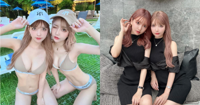 Plastic Surgery Twins Who Underwent $300K Makeover Reveal Their 'Before' Look