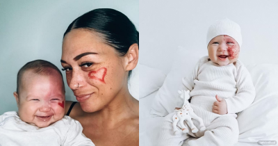 Mom Labeled 'Monster' For Lasering Baby's Face