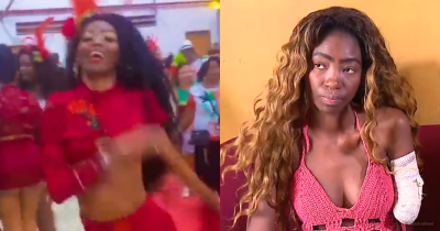 Samba Dancer Goes In For Surgery On Her Uterus But Wakes Up With Arm Amputated