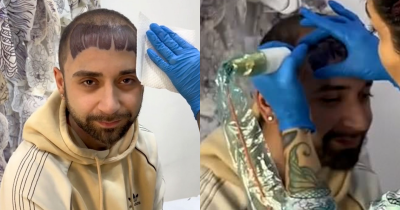 Man Going Bald Gets Fringe Tattooed On His Head