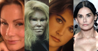 Celebrities Who Spent A Lot Of Money On Plastic Surgeries