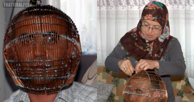 In A Desperate Attempt, Man Locks His Head In Cage To Quit Smoking