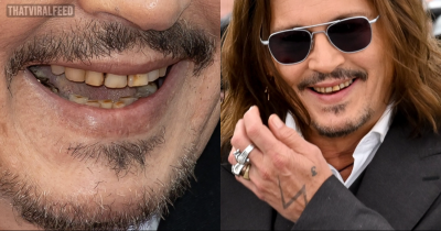 Fans Repulsed By Johnny Depp&rsquo;s Brown Rotting Teeth