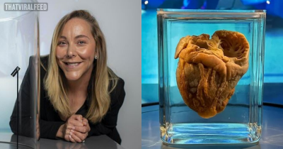 Surreal Moment When Woman Visits Her Own Heart Inside Museum 16 Years After It Was Removed