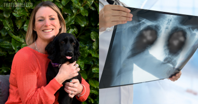Woman Diagnosed With Stage Four Lung Cancer Despite Never Smoking