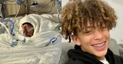 16-Year-Old Burns Nearly 80% Of Body After Doing Terrifying TikTok