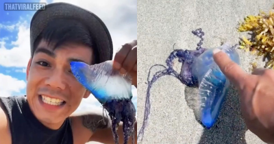 TikToker Licks "JellyFish" Without Realizing It's A Deadly Portuguese Man o' War