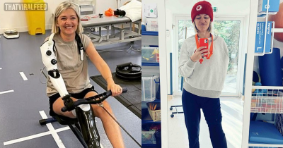 Mom Run Over By Two Tube Trains Gets Bionic Arm That Reads Her Mind