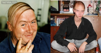These Hair-Raisingly Bad Comb Overs Will Leave You In Stitches