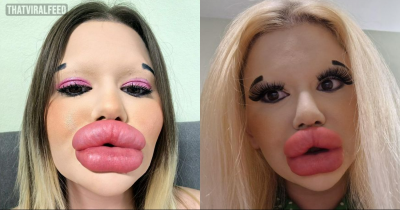 Woman With 'World's Biggest Lips' On Hunt For A Man But Admits She's 'Picky'