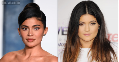 Kylie Jenner Denies Having Had Surgery On Her &lsquo;Whole Face&rsquo;