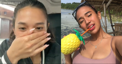 'I Spent $160 On Bunny Teeth &mdash; I Love Them But Haters Call Me Ugly'
