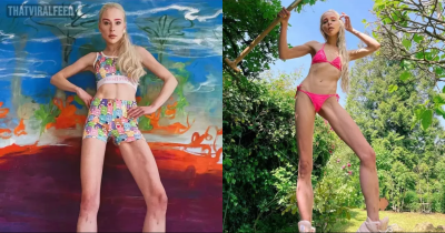 Woman Who Spent $165,000 To Extend Her Legs By 5.5 Inches Now Has Huge Regrets