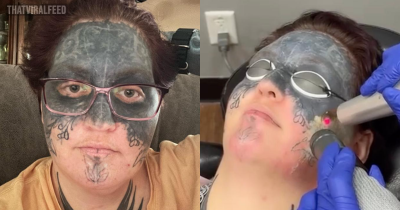 Woman Whose Face Was Tattooed Against Her Will Has &lsquo;Life Changed&rsquo; After Stranger Offers To Help With Removal