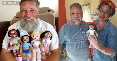 Grandfather With Vitiligo Crochets Dolls To Make Children With This Condition Feel Better