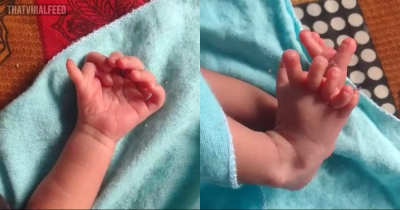 Baby Born With 26 Fingers And Toes Hailed As &lsquo;Second Coming Of Hindu Goddess&rsquo;