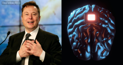 Elon Musk&rsquo;s Company Neuralink Looking For First Volunteer To Have Robot Insert Wires Inside Their Skull
