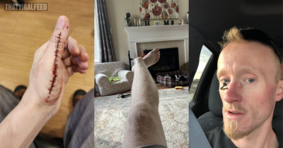 Brutal Accidents That HAD To Hurt