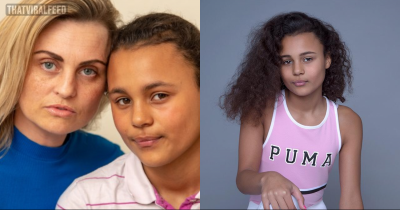 Mom Wants Teen Daughter To Get Plastic Surgery Because 'Ugly People Get Nowhere'