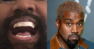 Kanye West&rsquo;s $850k Titanium Dentures Are &lsquo;Fixed And Permanent&rsquo; And Go &lsquo;Beyond Veneers Or Grills&rsquo;