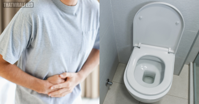 Man Constipated For 22 Years Needed Surgery To Remove Faeces That Had Accumulated Since Birth