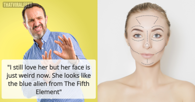 Plastic Surgery Puts Marriage To Test When Husband Tells Wife She Looks Unattractive After Surgery