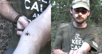 Man Lets A Black Widow Spider Bite Him On Purpose To "Debunk Myths" And The Results Are Shocking