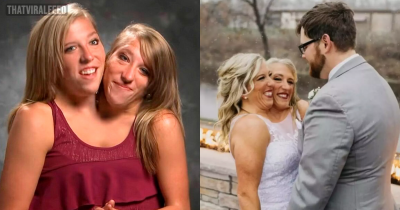 People Are All Asking The Same Thing After Conjoined Twin Abby Hensel's Marriage Is Revealed