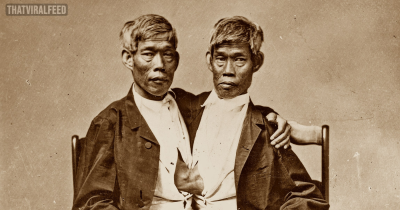 World Famous Conjoined Twins Fathered 21 Children By 2 Sisters During Their Lifetime