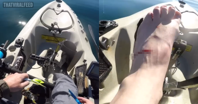 Mantis Shrimp Punches Hole In Fisherman's Foot After Being Caught