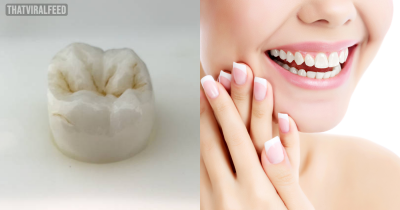 The World's First Drug That Can Regrow Teeth Has Been Approved For Human Trials This Year