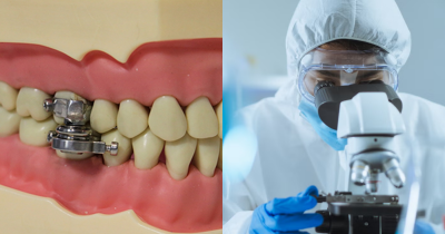 Scientists Invented 'Weight-Loss Device' That Locks Jaw Shut And People Are Outraged