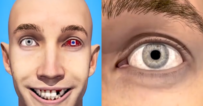 People Left 'Terrified' After Watching 'Creepy' Video Showing How Eye Surgery Is Done