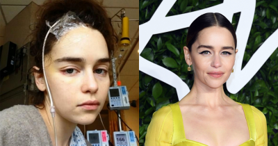 Emilia Clarke Worried About Losing Her Role On Game Of Thrones Following Two Severe Aneurysms
