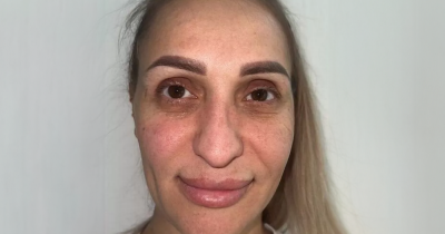 Woman's Dramatic Turkey Surgery Makeover Stuns As People Say She 'Needs New Passport'