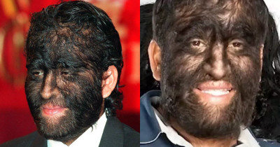 World's Hairiest Family Gets Huge Support From Fans After Getting Trolled